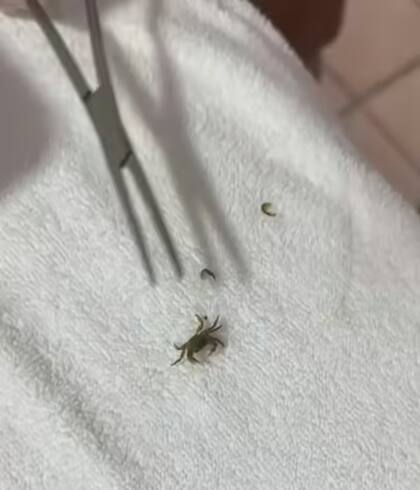 El pequeño cangrejo fue sacado de la oreja del menor y fotografiado en el sanatorio privado