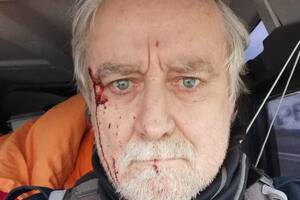 Un periodista suizo fue atacado por militares rusos en Ucrania