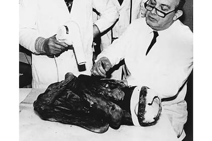 El peso de la momia en mayo de 1986 era de 11 kilos con 200 gramos, algo más de un tercio del peso originario estimado, producto de una parcial desecación
