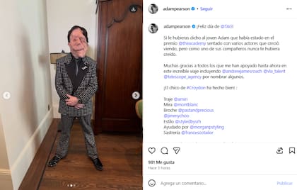 El posteo de Adam Pearson que se viralizó en Instagram