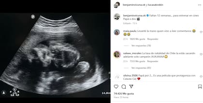 El posteo de la ecografía para el Día del Padre que llamó la atención de los seguidores de Vicuña