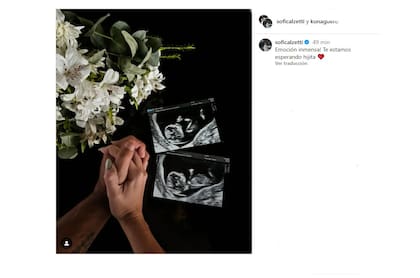El posteo donde la pareja confirmó la noticia (Foto: Captura Instagram/@sofiacalzetti)