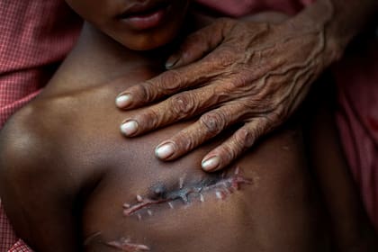 Mohammed Shoaib, de 7 años, recibió un disparo en el pecho antes de cruzar la frontera de Myanmar en agosto (5 de noviembre de 2017)
