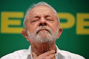 La operación a Lula por una artrosis en la cadera transcurrió "sin complicaciones"