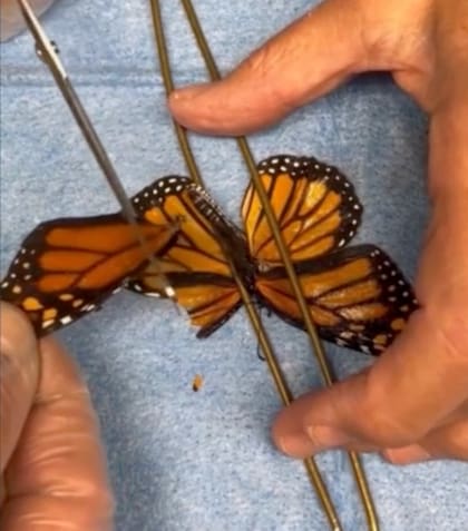 El primer paso del trasplante consistió en encontrar un donante adecuado para el ejemplar vivo y, posteriormente, anestesiar al insecto