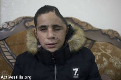 El primo de Ahed, herido por las fuerzas israelíes