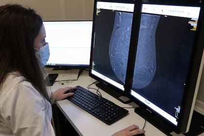 El profesional puede detectar mediante una mamografía por contraste una imagen dudosa o sospechosa mucho antes: a veces hasta 2 o 3 años antes de que un nódulo pueda ser palpable (Archivo)