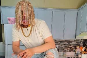 Un rapero se implantó cadenas de oro en lugar de pelo y el resultado es asombroso 