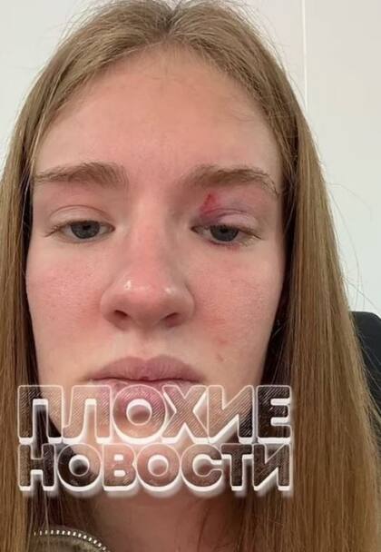 El rostro de Masha luego de que un pez la mordiera