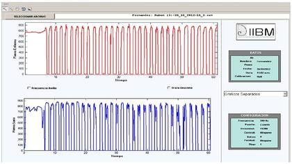 El sistema permite registrar los pasos a lo largo del tiempo y la mejoría durante la rehabilitación