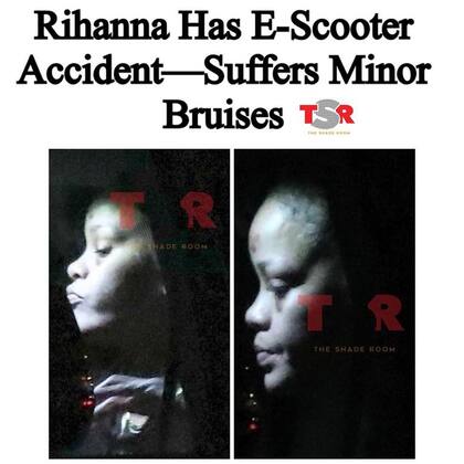 El sitio TMZ publicó fotos de la cantante en donde se ven las secuelas del accidente