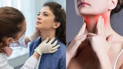 El software recién aprobado emplea ultrasonidos de tiroides tanto mononodulares como multinodulares (Foto: iStock)