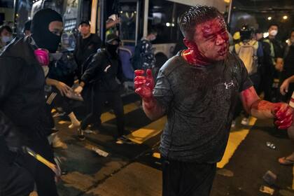 Un manifestante enmascarado y con un martillo en la mano ataca a un hombre sospechoso de ser activista pro Beijing