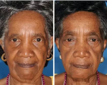 El tabaquismo tiene consecuencias directas sobre el organismo: la de la izquierda es la no fumadora (Foto: Lad Bible)