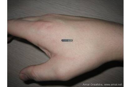 El tamaño de un chip RFID permite un implante subcutáneo sencillo