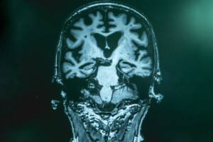 El trabajo se realizó sobre un total de 111.326 personas a las que se les había diagnosticado la enfermedad o tenían parientes cercanos con esta afección, y 677.663 controles sanos, cuyos datos proceden de varias grandes cohortes europeas agrupadas en el consorcio European Alzheimer & Dementia BioBank (EADB).