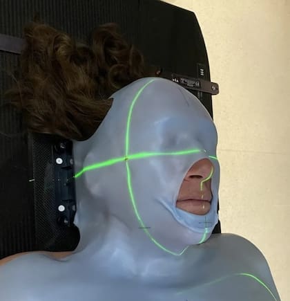 El tratamiento de Claire para extirpar el tumor