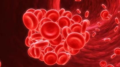 El trombo o coágulo puede viajar e instalarse en el corazón, pulmón o cerebro