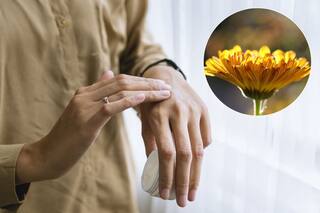 La hierba medicinal que cura cicatrices y que tiene una flor con la que se combaten infecciones