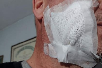 El vecino cordobés necesitó cinco puntos de sutura tras ser atacado por uno de los dogos