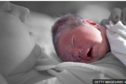 El vérmix -un ungüento blanquecino que cubre la piel del bebé- no suele verse en los partos de ficción. Tampoco se suelen mostrar las dificultades posparto