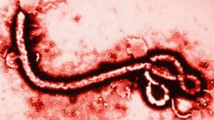 El virus del ébola bajo el microscopio, está cerca de tener su vacuna