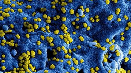 El virus del MERS en una imagen coloreada artificialmente
