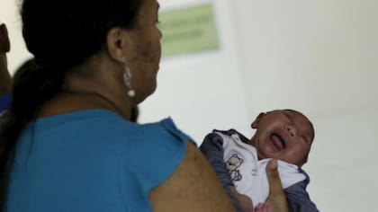 El virus del zika causa microcefalia en los recién nacidos