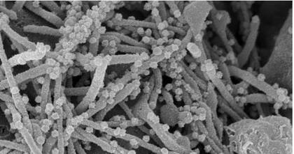 El virus utiliza los filopodios para salir de la célula infectada y para infectar otras células cercanas