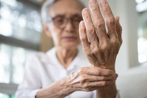 La mejor manera de prevenir la artritis después de los 50 años