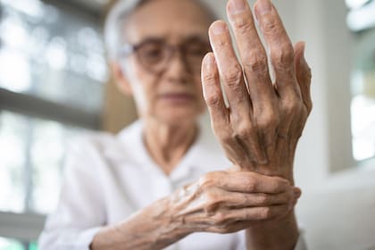 La artritis reumatoide tiene que ver con una alteración del sistema inmune