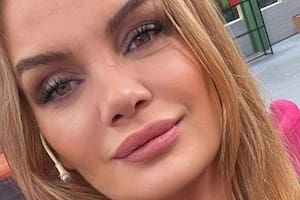 El mal momento de Eliana Guercio por un tratamiento estético