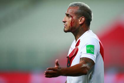 Para Miguel Trauco, cuyo Perú perdió, el partido contra Brasil conllevó sangre, sudor y lágrimas.