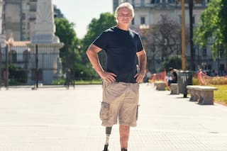 Festejaba un cumpleaños cuando estalló una bala de cañón: la explosión le arrancó una pierna y mató a su mejor amigo