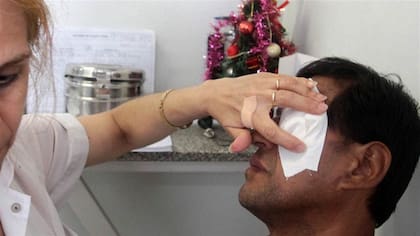 Internado en Córdoba: un niño de 9 años está grave luego de que le explotara pirotecnia en la cara