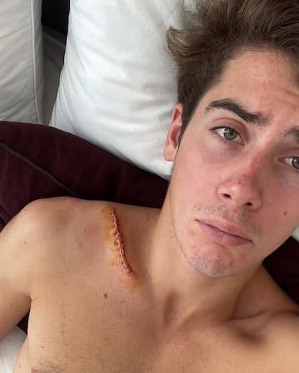 En 2023 se rompió la clavícula; lo operaron y dos semanas despúes ganó la spint de Monza en la Fórmula 3 (Foto: Instagram @francolapinto)