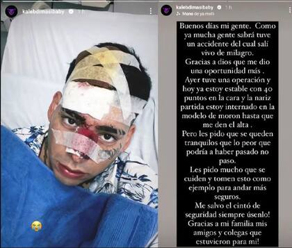 En abril pasado, el rapero Kaleb Di Masi habló del accidente que tuvo