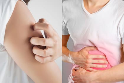 En caso de percibir sus síntomas, la hepatotoxicidad puede tratarse a tiempo y, así, evitar problemas de salud mayores