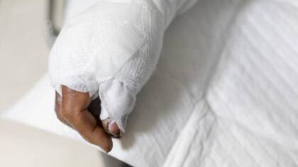 En casos severos, una quemadura puede conllevar una atención médica exhaustiva para prevenir el impacto de la lesión
Foto: iStock