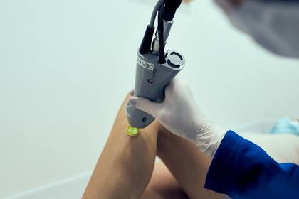 En Definit utilizan la tecnología Candela con el Láser Alexandrita.