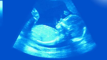 En ecografías se han observado fetos con hipo (FOTO: GETTY)