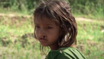 En el documental Smile Pinki, una trabajadora social en la India intenta ayudar a una niña que es discriminada por su labio leporino