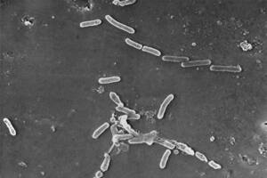 EEUU retira gotas oculares EzriCare por brote infeccioso