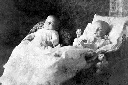 En este caso, un gemelo murió mientras el otro sobrevivió. El bebé muerto está rodeado de flores