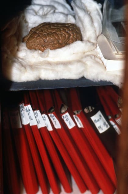 En la Academia de Ciencias Médicas de Rusia tienen un modelo a escala en cera del cerebro de Lenin, que permite verlo tal y como lucía en el momento de su muerte.