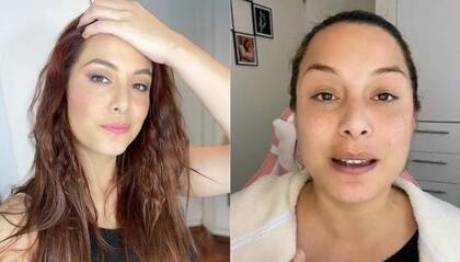 En la actualidad, continúa en tratamiento con quimioterapias