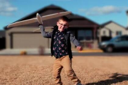 En la actualidad, Maverick ya no tendrá que someterse a más operaciones. FOTO: Hospital presbiteriano de Nueva York