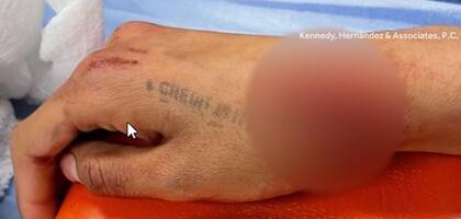 En la demanda se incluyeron fotografías de las lesiones de la estudiante de secundaria de la escuela en Nuevo México