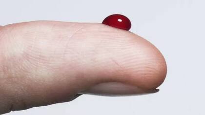 En la diabetes contamos con los puntos de corte para conocer los niveles saludables de glucosa