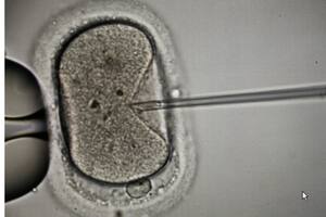 Fertilidad: disminuyen la cantidad y la calidad de los espermatozoides